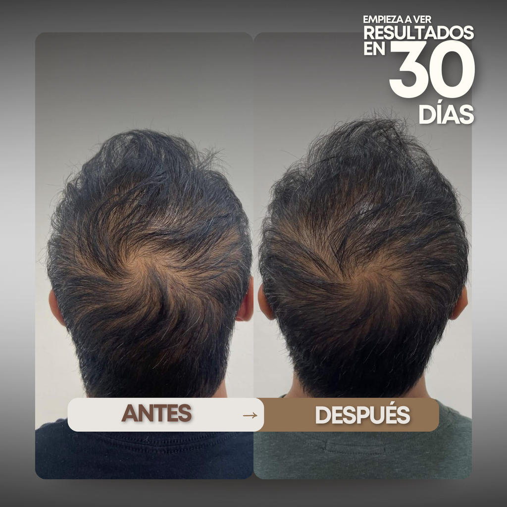 Tónico Capilar Vittale — Paso 1