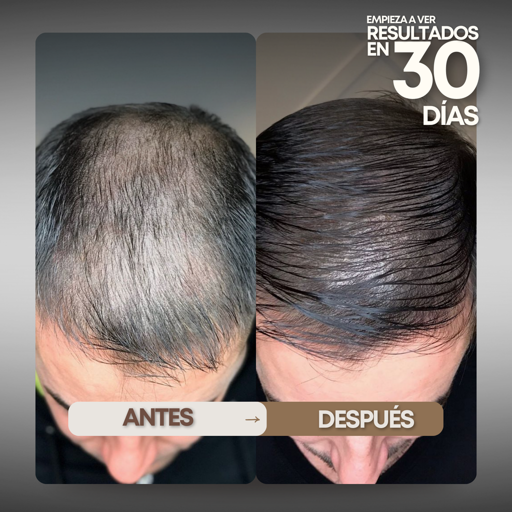 Tónico Capilar Vittale — Paso 1