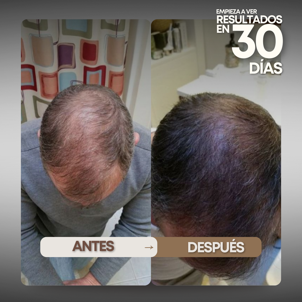 Tónico Capilar Vittale — Paso 1