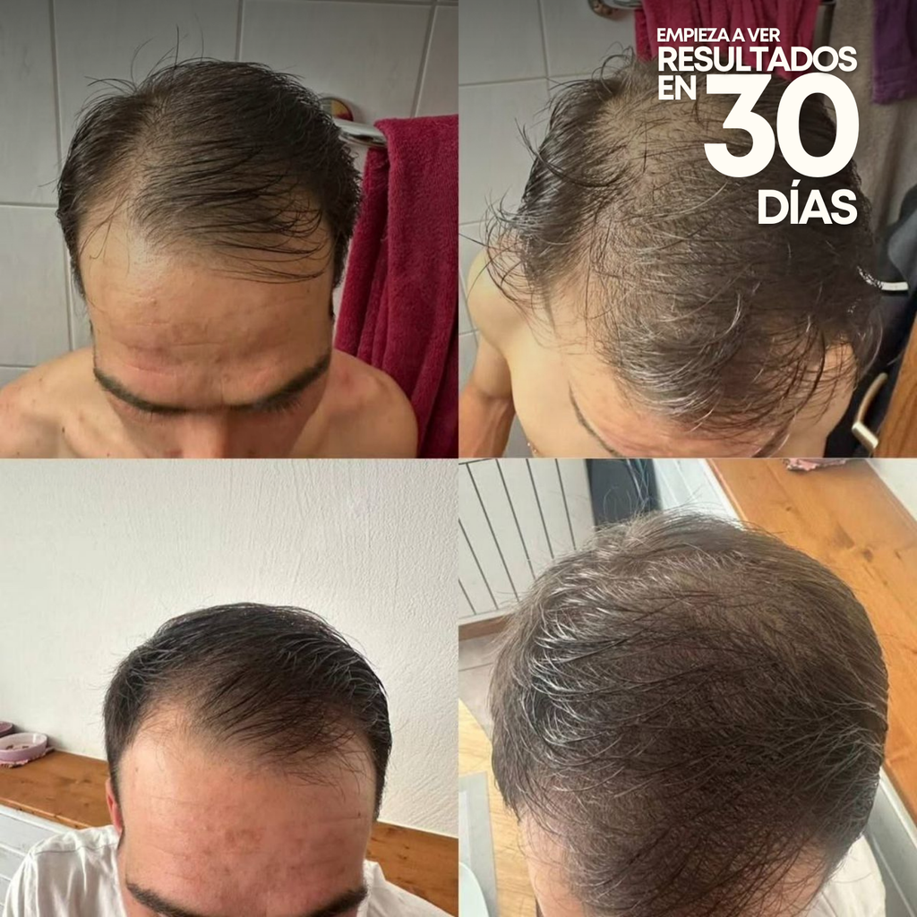 Tónico Capilar Vittale — Paso 1